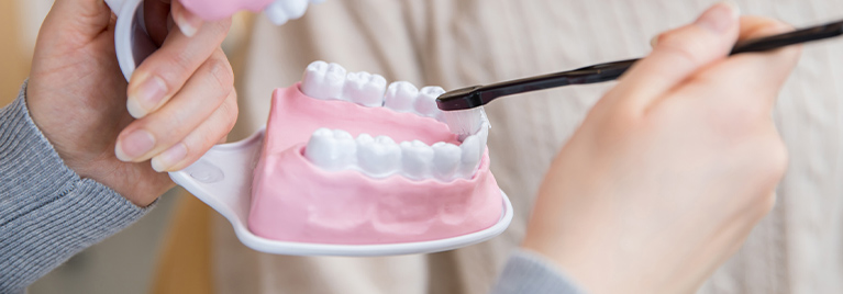 予防歯科の特徴